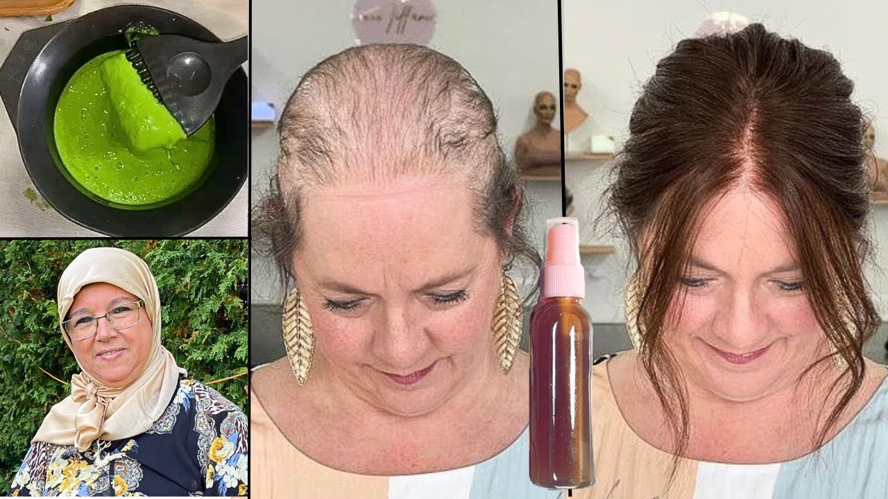 الى رشيتي شعرك بهذا العلاج القوي لتساقط الشعر و طبقتي بعده هذا الماسك ❌ممنوع تستخدمي مزال الشيشوار 💨