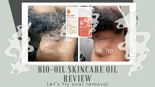 Bio Oil Skincare Oil Review