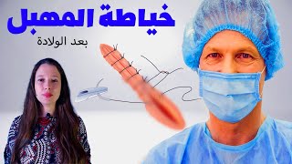 هل يمكن خياطة المهبل بعد الولادة؟