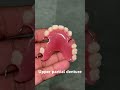 Upper partial denture 😬😬😬#apexdental #splittooth #orthodontist #dentistry #partialdenture