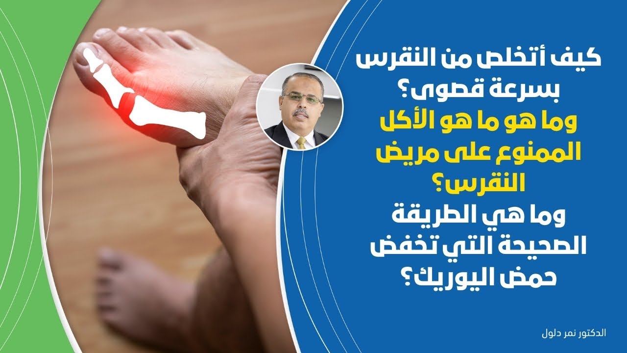 الان ... علاج النقرس النهائي خلال مدة قصيرة  ما لا تعرفه عن اليورك اسيد وكيف تحمي نفسك من أفظع ألم