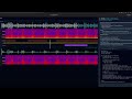 The Lung Listener: Vibe Code with Gemini 3 Pro Hackathon Submission
