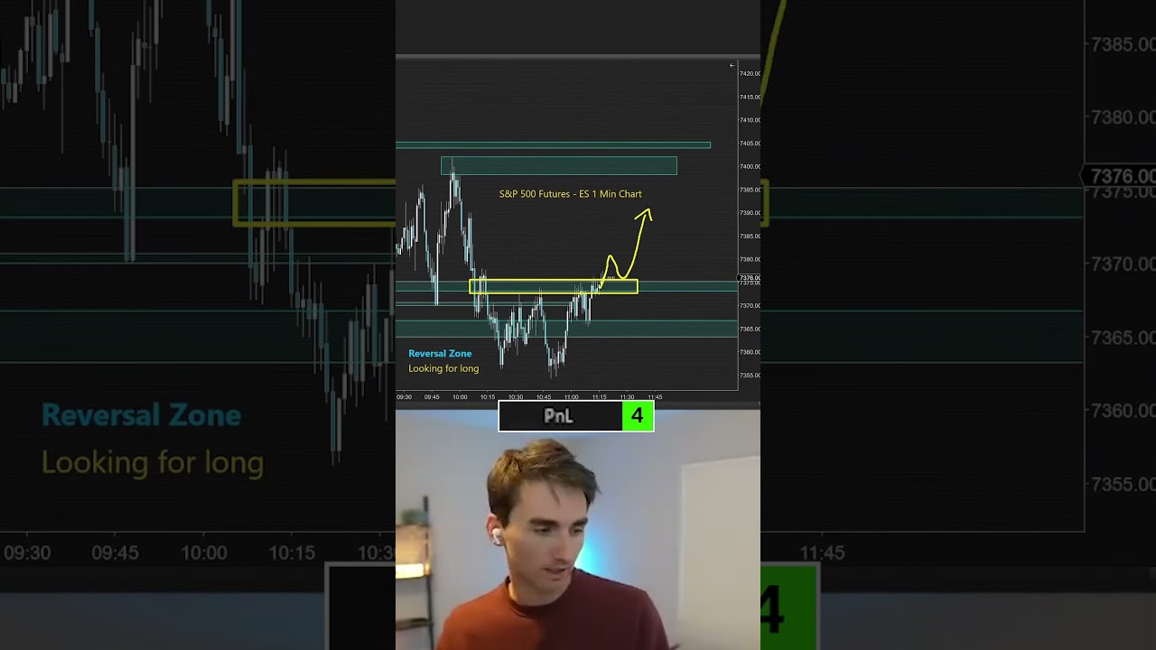 B vs A Trading Setups B vs A Trading Setups