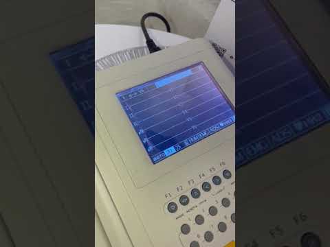 1 Кардиограф ECG