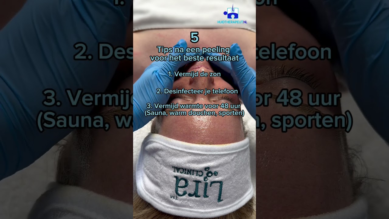 5 tips na peeling 