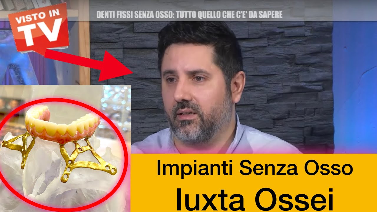 Denti Fissi Senza Osso: Dr Palmas Intervista TV