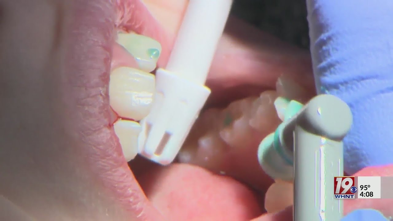 Guntersville Dentist Hosts Free Dental Service, Food Drive Aug 25