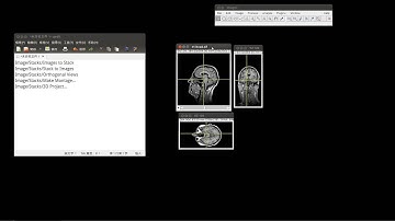 14 imagej的stack應用