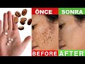 % 💯EFFECTIVE! MIX ASPIRIN AND COFFEE, WIPE OFF DARK SPOTS ON THE FACE IN 10 MINUTES!