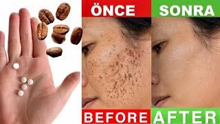 % EFFECTIVE! MIX ASPIRIN AND COFFEE, WIPE OFF DARK SPOTS ON THE FACE IN 10 MINUTES!