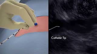 Download Lagu clarivein MP3