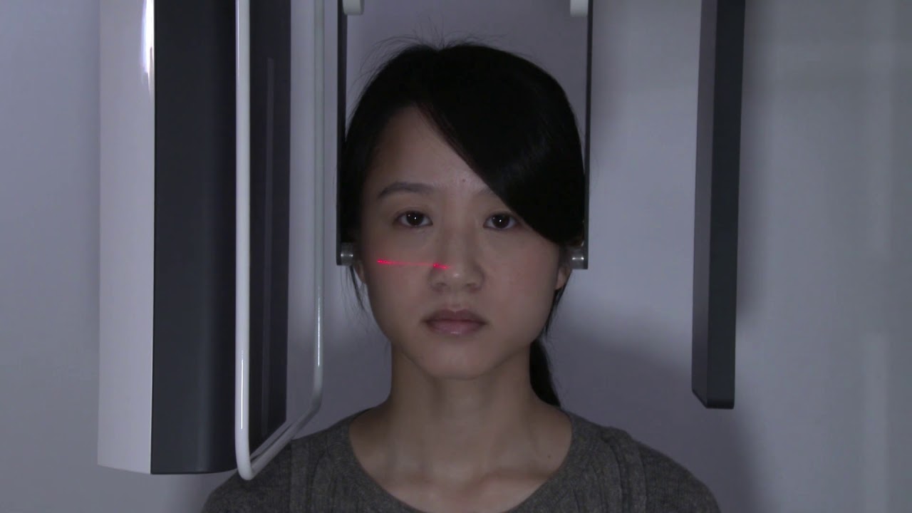 Chụp Cephalo nắn chỉnh răng với máy CBCT Morita X800 - YouTube