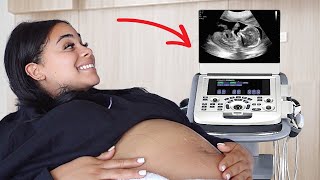 SEEING OUR BABY FOR THE FIRST TIME!! *emotional*