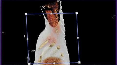 The Chest with Cinematic Rendering