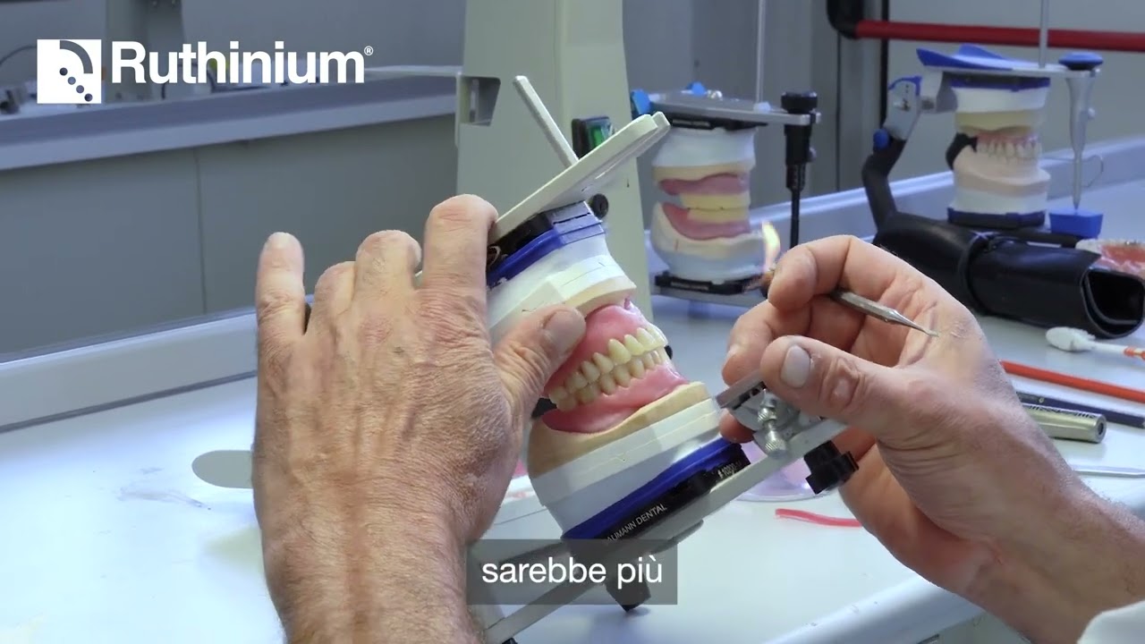 Lezione 2 | Montaggio denti superiori