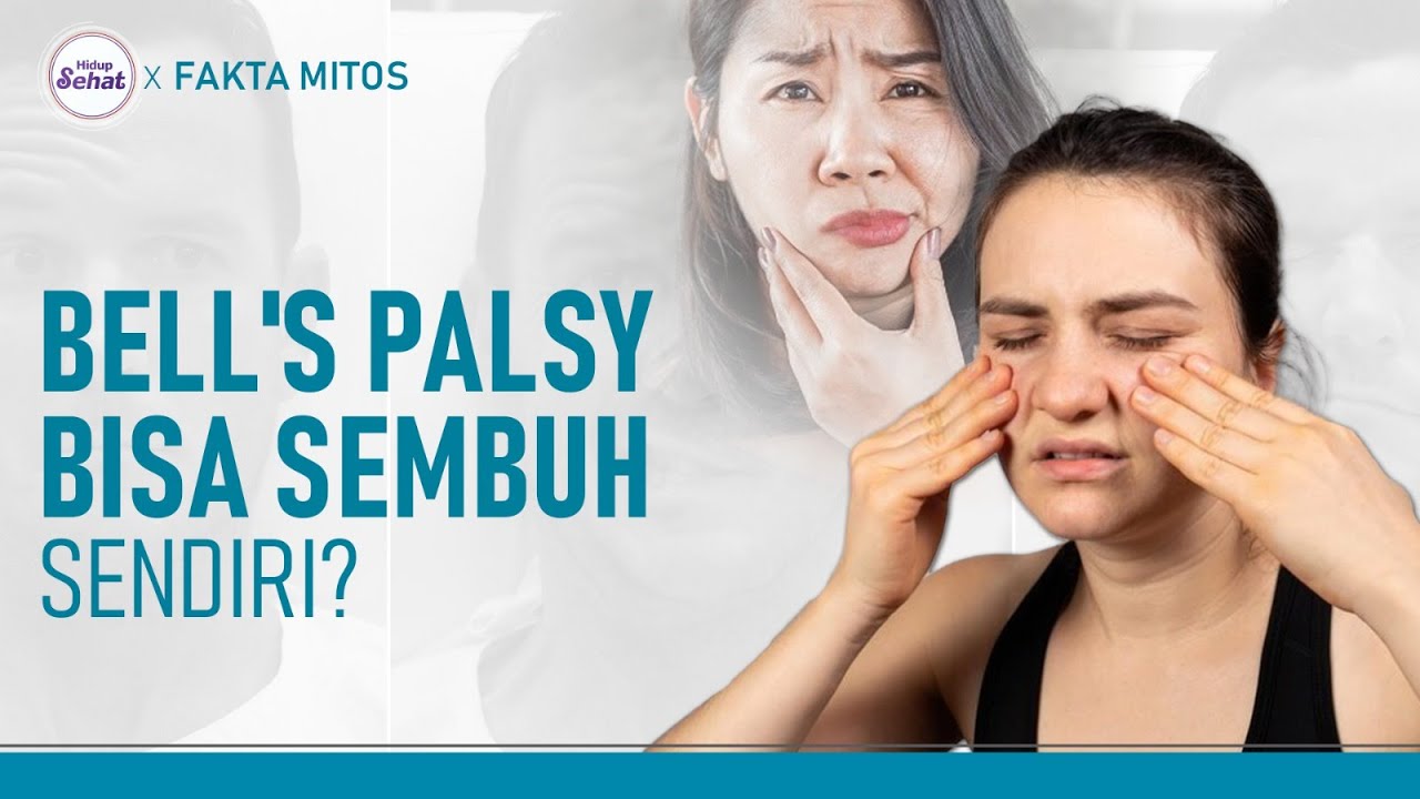 Tidak Berbahaya, Bell's Palsy Bisa Sembuh Sendiri? | Hidup Sehat tvOne