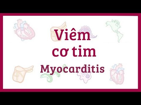 Viêm cơ tim - Nguyên nhân, triệu chứng, chẩn đoán, điều trị, bệnh lý