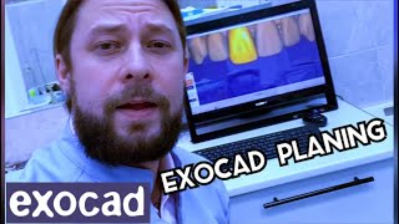 Exocad modeling, teeth modeling with program exocad
