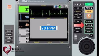 Transcutaneous Pacing -ACLS Prep Series