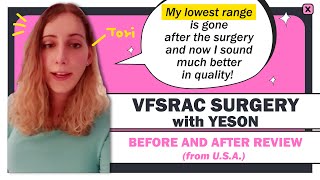 YESON VOICE CENTER- Tori's VFSRAC surgery review