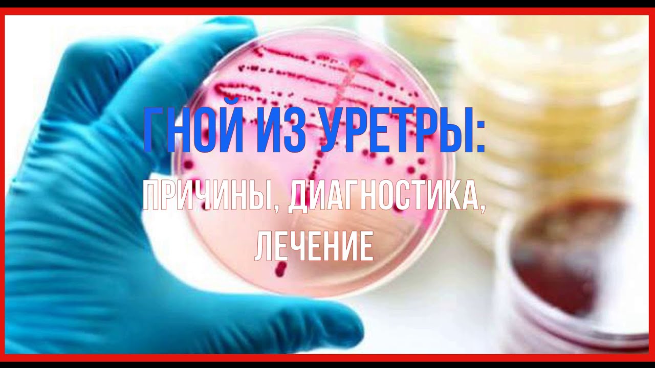 Гной из уретры: причины, диагностика, лечение - YouTube