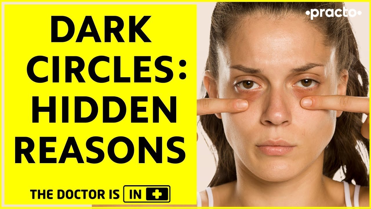 Dark Circles Under Eyes Reasons For Dark Circles & Sunken Eyes (In