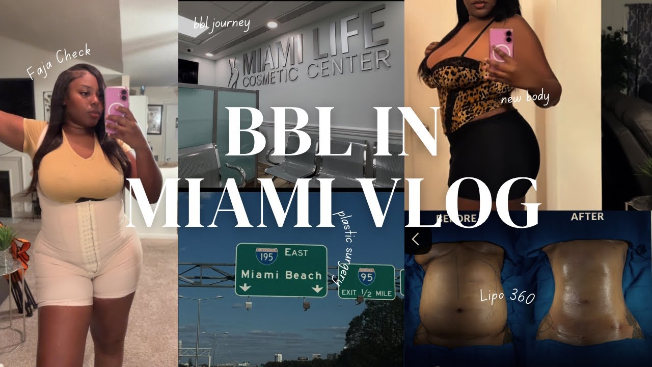 VLOG: Getting Lipo 360 + BBL | Recovery + Results! - YouTube