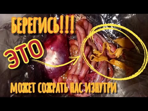Осторожно ЗАРАЖЁННЫЕ УТКИ/Опасная охота на уток/ПАРАЗИТЫ/ОПАСНО ДЛЯ ЧЕЛОВЕКА/Parasites