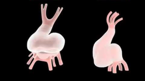 sự hình thành tim trong phôi thai