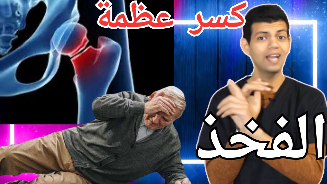 المشى بعد كسر عظمة الفخذ/كسر العظمة