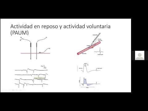 Vídeo: Se Presentan Descripciones De Alienígenas Potenciales - Vista Alternativa