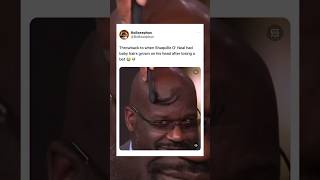 Shaquille O’ Neal grew baby hairs on his head