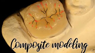 Indirect Composite Tooth Restoration, Dentistry .Composite Restoration Of Dental Anatomy.