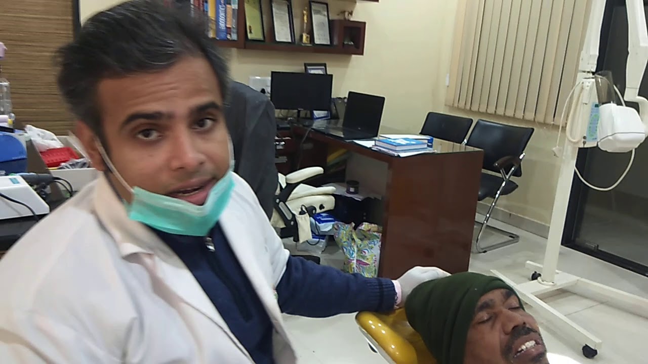 Open tray impression technique