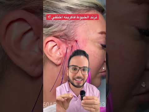 ترند الخيوط 