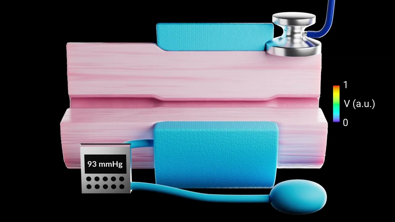 The fundamental mechanisms of the Korotkoff sounds generation