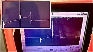 Secondary Waveform Interpretation P1