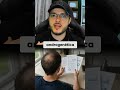 VITAMINA D E ZINCO BAIXOS PODEM ESTAR ACELERANDO SUA QUEDA DE CABELO