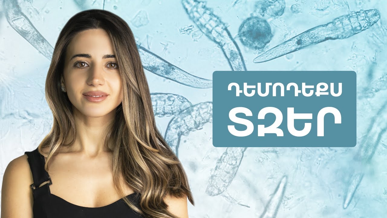 Դեմոդեքս տզեր | DermaGuide 05