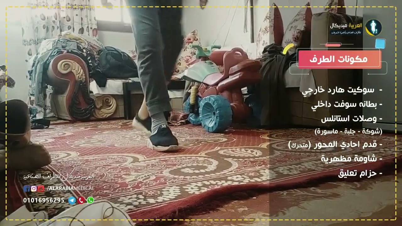 طرف صناعي تحت الركبة