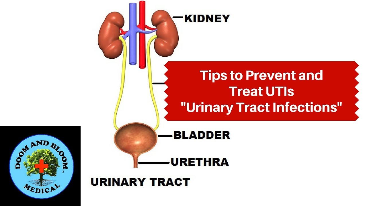 5 Ways to Fight Off UTIs—Or Soothe Symptoms If Youve Already Got One advise 5 Ways to Fight Off UTIs—Or Soothe Symptoms If Youve Already Got One forecast