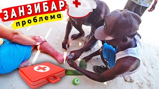 ПРОБЛЕМА НА ЗАНЗИБАРЕ вызвали доктора Опасность на пляжах Занзибара Отдых на Нунгви 2021
