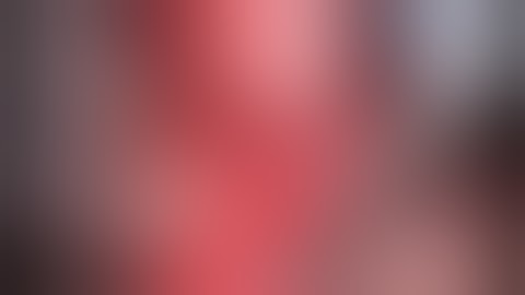 Inguinal Hernia repair with anterior PROGRIP onlay mesh (DR CHASTAN)