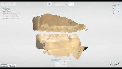 How to change bite scan in 3shape trios