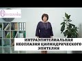 Интраэпителиальная неоплазия цилиндрического эпителия - Др. Елена Березовская