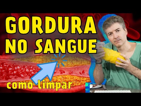 Gordura no Sangue: Como prevenir a formação de placa nas artérias