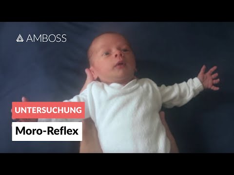 0 - Was ist der Moro-Reflex?