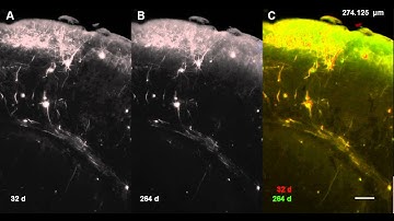 Green flourescence in a mouse brain