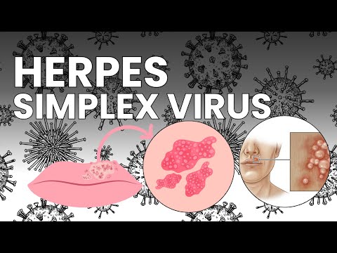 Understanding the herpes simplex virus: Facts, symptoms, and coping | Republic News German