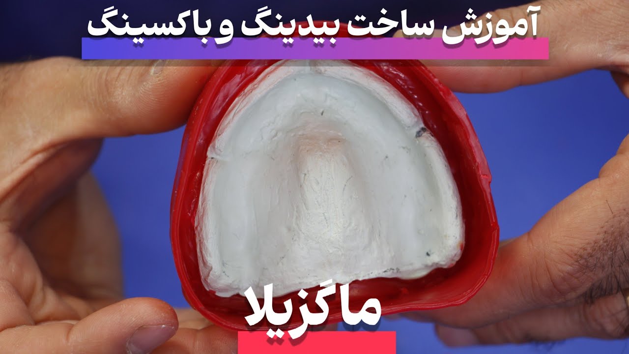 پروتز کامل - بیدینگ و باکسینگ برای ماگزیلا